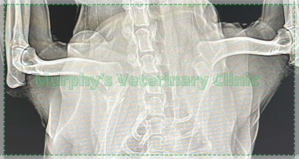 Bone and Joint Infections