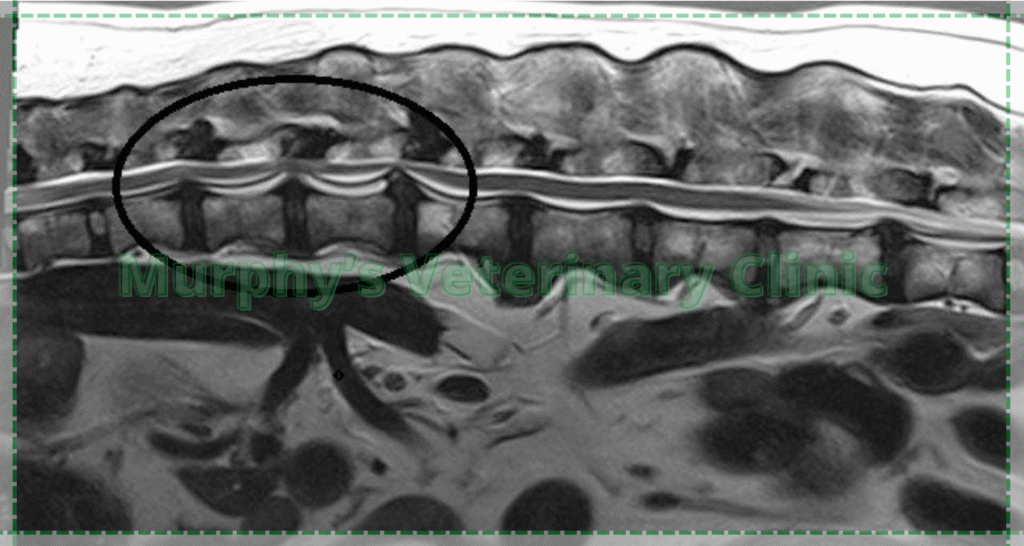 Intervertebral Disc Disease